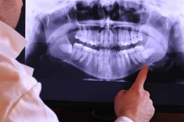 Best Emergency Treatment for Toothache in Netcong, NJ